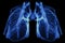 Chest x-ray image of dextrocardia and situs inversus patient that demonstrated heart,lungs,ribs,bones and muscles look like