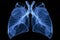 Chest x-ray image of dextrocardia and situs inversus patient that demonstrated heart,lungs,ribs,bones and muscles look like