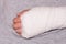 A child broken arm in plaster case, hand injury because of accident, forearm bones fracture