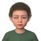 A child with esotropia, 3D illustration