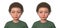 A child with exotropia and the same healthy person, 3D illustration