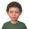 A child with hypertropia, 3D illustration