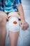 Child injured. Wound on the child\'s knee with bandage.