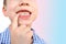 Child, kid shows with his finger a milk tooth that sways and hurts, the concept of pediatric dentistry, dental treatment and