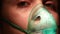 child with a mask from an inhaler on his face close-up