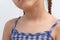 Child neck with birthmark