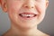 A child`s smile without lower baby teeth. A hole in a child`s smile. Fun concept