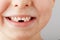 A child`s smile without lower baby teeth. A hole in a child`s smile. Fun concept