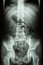 Child\'s spine , abdomen , pelvis , hip