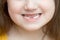 Childish face lower part with missing front lower milk teeth in a smiling mouth