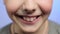 Children dental health concept. Kid laughs. Mouth close up. Boy toothy smiling.