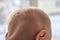 Children`s nape with sparse white hair, close-up