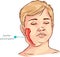 Children salivary gland swelling vector illustration