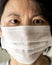 China woman wear medical mask protection from flu virus