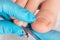 A chiropodist gives a pedicure to the client& x27;s feet, cutting dry skin with clippers. Close up. The concept of foot