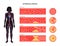 Cholesterol and atherosclerosis