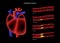 Cholesterol heart disease