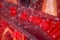 Cholesterol plaque in artery, Blood vessel with flowing blood cells