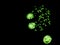 Chromosomes under fluorescence microscope, green colored Human chromosomes from blood