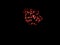 Chromosomes under fluorescence microscope, red colored Human chromosomes from blood