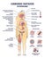 Chronic fatigue syndrome with symptom and risk factors list outline diagram