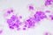 Chronic myeloid leukemia cells