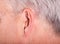 Cic hearing aid in the ear