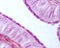 Ciliated columnar epithelium