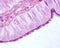 Ciliated columnar epithelium