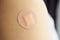 circle brown adhesive bandage on patient arm after medicine injection or vaccination