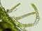Cladophora sp. algae under microscopic view, Filamentous green algae