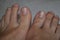 Clean male toes without any dermatological issues on white background.