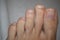 Clean male toes without any dermatological issues on white background.