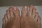 Clean male toes without any dermatological issues on white background.