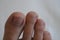 Clean male toes without any dermatological issues on white background.
