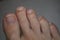 Clean male toes without any dermatological issues on white background.