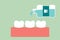 Cleaning teeth by mouthwash, dental health care