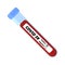Clinical test sample tube with positive diagnosis of blood for COVID-19, coronavirus. Testing blood for 2019-ncov. Medicine and