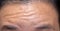Close-up asian man with frowning him forehead