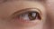 Close up of Asian woman\'s eye