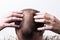 Close-up balding head of a young man on a white isolated background