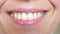 Close up on a beautiful smile of a young woman. girl smiling teeth and lips close-up.