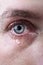 Close up of blue eye of man crying in tears sad and full of pain in depression