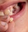 Close-up of a boy\'s milk tooth fell out