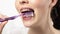 Close up of Caucasian woman with ligature braces brushing teeth using manual toothbrush. Concept of orthodontic