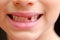 Close up child missing milk tooth