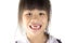 Close up child\'s month with missing teeth