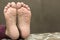 Close-up of children wrinkled feet after long bath