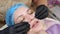 close-up, cosmetician in medical gloves applies evenly cosmetic cream or sunscreen to female face after peeling