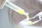 Close up of cough syrup dose in pipette and spoon